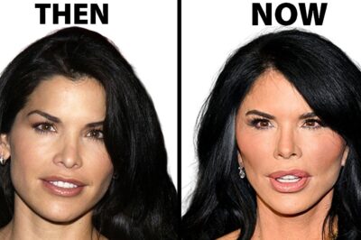 How is Lauren Sánchez So Rich, But Her Plastic Surgery Is So Bad?