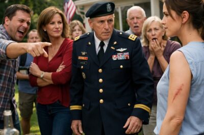 “Why Don’t You Cover That Scar?” My Brother Asked. “No One Wants To See That.” My Aunt Snorted. “She Loves The Attention.” I Said Nothing. Then Her Husband, A Retired Colonel, Saw My Arm And Froze: “Operation Iron Storm, Ma’am?” My Aunt’s Jaw Dropped.